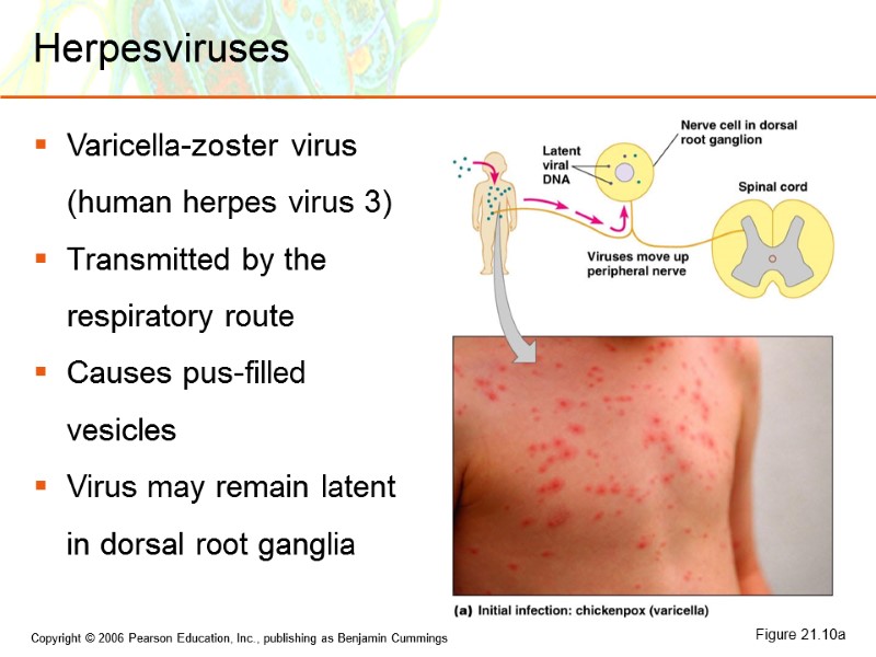 Herpesviruses Varicella-zoster virus (human herpes virus 3) Transmitted by the respiratory route Causes pus-filled